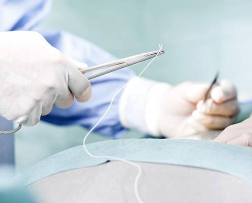 Persona haciendo suturas